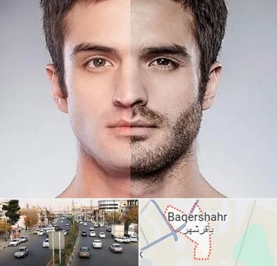 کاشت ریش و سبیل در باقرشهر