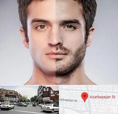 کاشت ریش و سبیل در خیابان آذربایجان