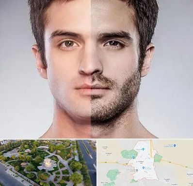 کاشت ریش و سبیل در کاشمر