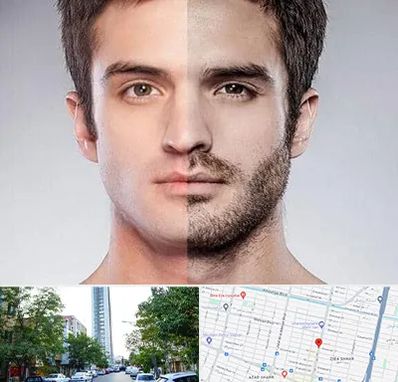 کاشت ریش و سبیل در امامت مشهد