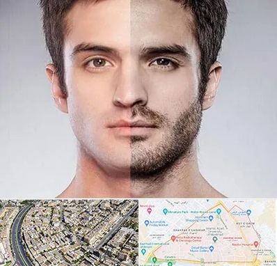 کاشت ریش و سبیل در شهرک غرب مشهد