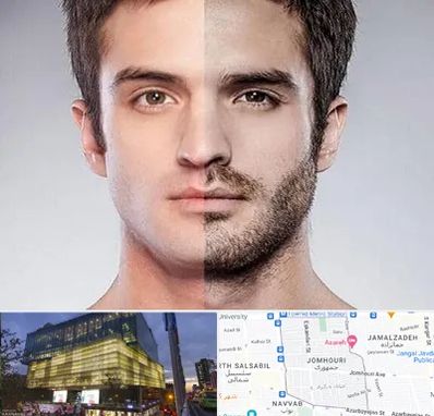 کاشت ریش و سبیل در جمهوری