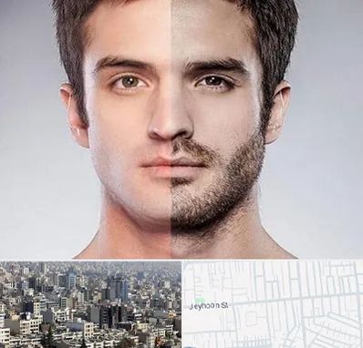 کاشت ریش و سبیل در جیحون