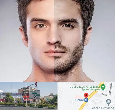 کاشت ریش و سبیل در هروی