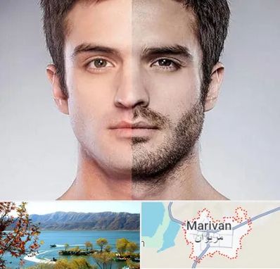 کاشت ریش و سبیل در مریوان