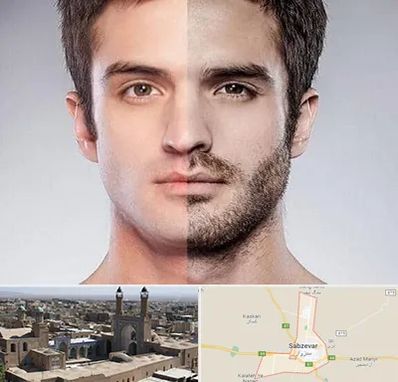 کاشت ریش و سبیل در سبزوار