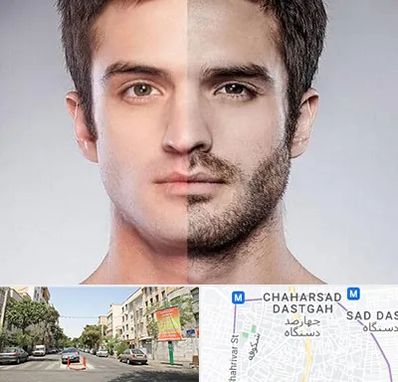 کاشت ریش و سبیل در چهارصد دستگاه