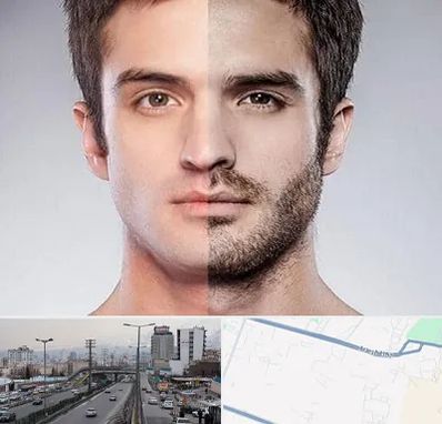 کاشت ریش و سبیل در بلوار ارتش