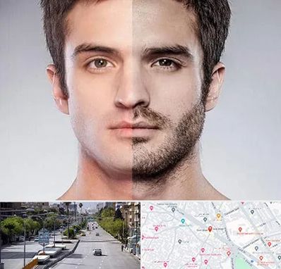 کاشت ریش و سبیل در خیابان زند شیراز