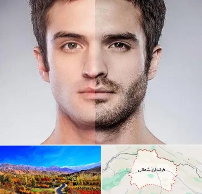 کاشت ریش و سبیل در خراسان شمالی