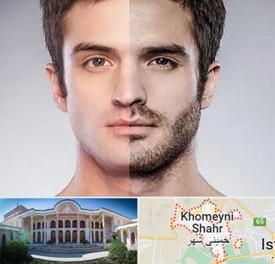 کاشت ریش و سبیل در خمینی شهر