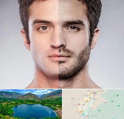 کاشت ریش و سبیل در رودبار