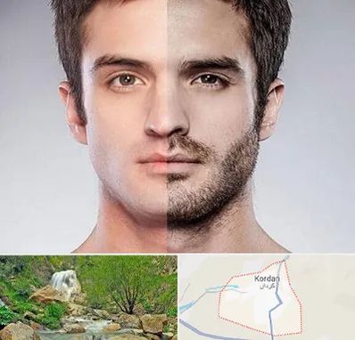 کاشت ریش و سبیل در کردان