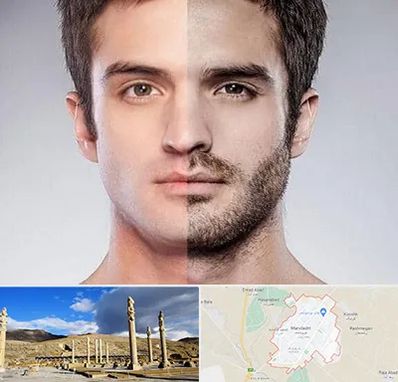 کاشت ریش و سبیل در مرودشت