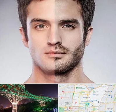 کاشت ریش و سبیل در منطقه 3 تهران