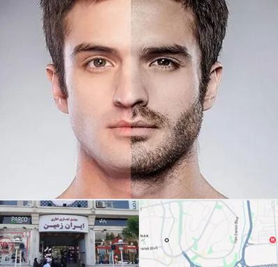 کاشت ریش و سبیل در ایران زمین