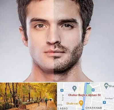 کاشت ریش و سبیل در چهارباغ اصفهان