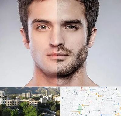 کاشت ریش و سبیل در دیباجی