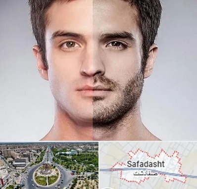 کاشت ریش و سبیل در صفادشت
