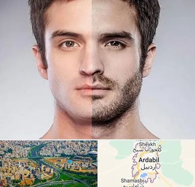 کاشت ریش و سبیل در اردبیل