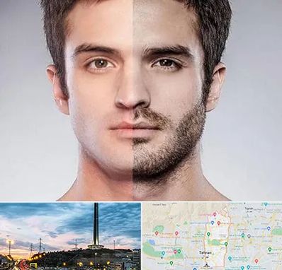 کاشت ریش و سبیل در منطقه 2 تهران