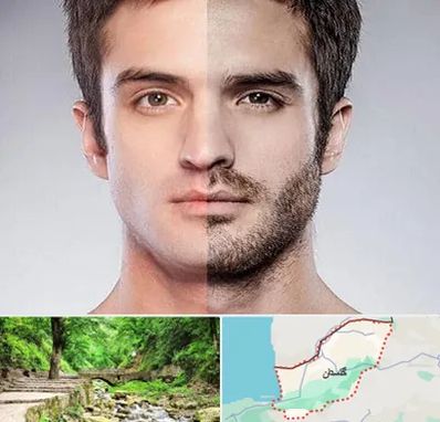 کاشت ریش و سبیل در گلستان