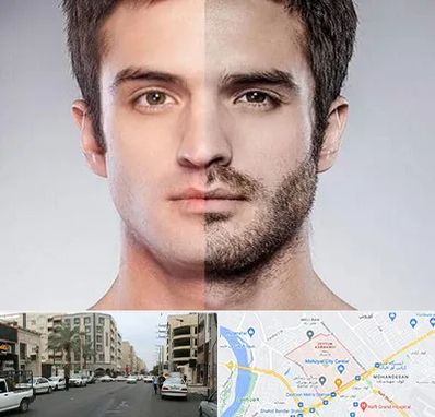 کاشت ریش و سبیل در زیتون کارمندی اهواز