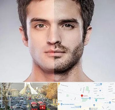 کاشت ریش و سبیل در خیابان آزادی