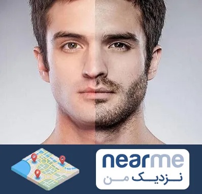 کاشت ریش و سبیل در نزدیک من