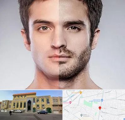 کاشت ریش و سبیل در زنبیل آباد قم