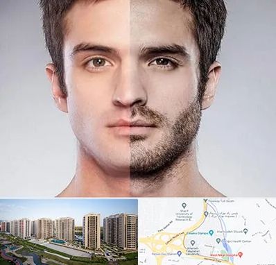 کاشت ریش و سبیل در المپیک