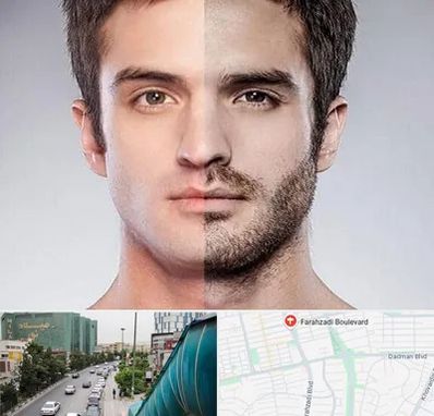 کاشت ریش و سبیل در بلوار فرحزادی