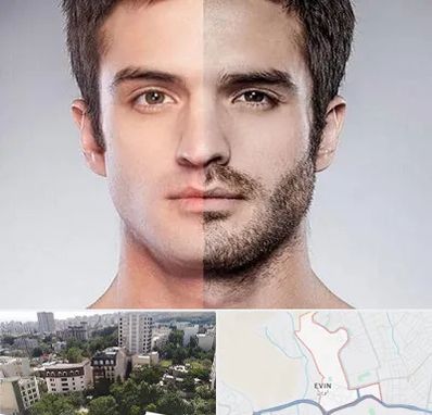 کاشت ریش و سبیل در اوین