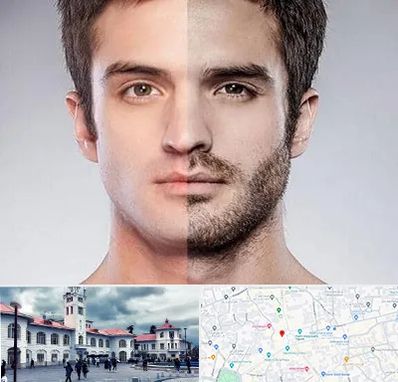 کاشت ریش و سبیل در میدان شهرداری رشت