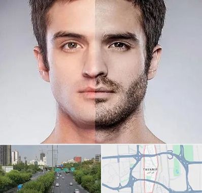 کاشت ریش و سبیل در توانیر