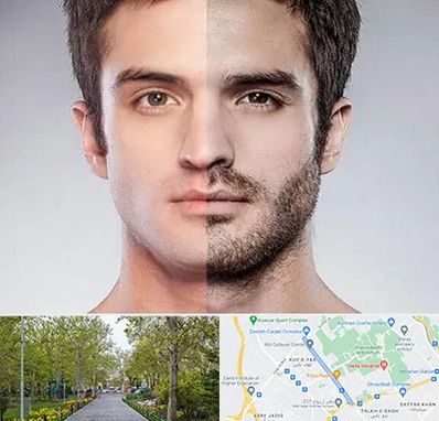 کاشت ریش و سبیل در قدوسی غربی شیراز