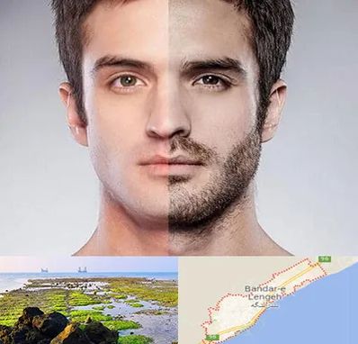 کاشت ریش و سبیل در بندرلنگه