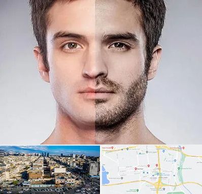 کاشت ریش و سبیل در شهرک راه آهن