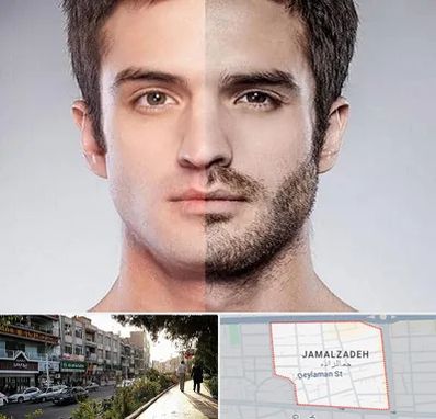 کاشت ریش و سبیل در خیابان جمالزاده