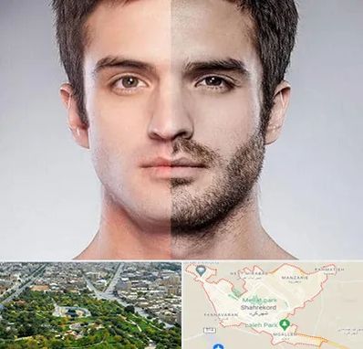 کاشت ریش و سبیل در شهرکرد