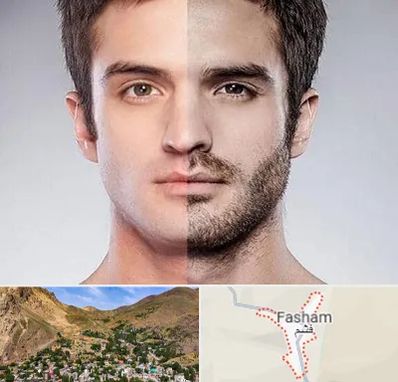 کاشت ریش و سبیل در فشم