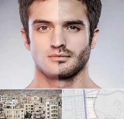 کاشت ریش و سبیل در اسکندری