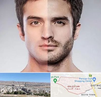 کاشت ریش و سبیل در شهرک گلستان شیراز