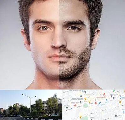 کاشت ریش و سبیل در میدان کاج