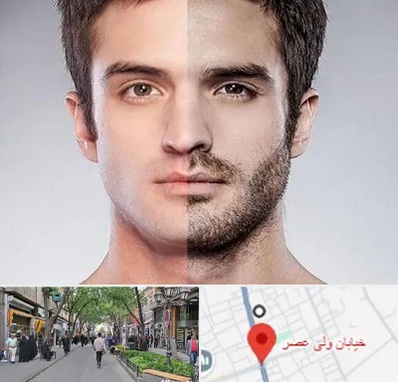 کاشت ریش و سبیل در ولیعصر شهریار