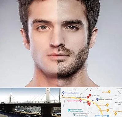 کاشت ریش و سبیل در پارک وی