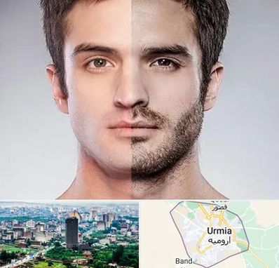 کاشت ریش و سبیل در ارومیه