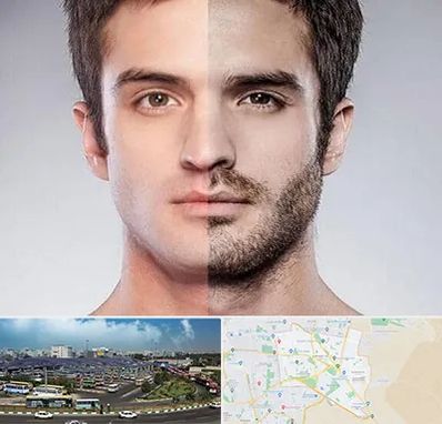 کاشت ریش و سبیل در منطقه 15 تهران