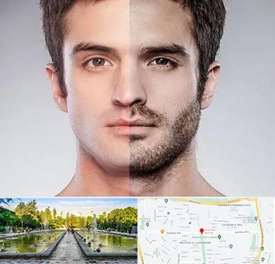 کاشت ریش و سبیل در سرسبز