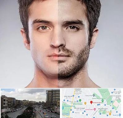 کاشت ریش و سبیل در بلوار فردوسی مشهد